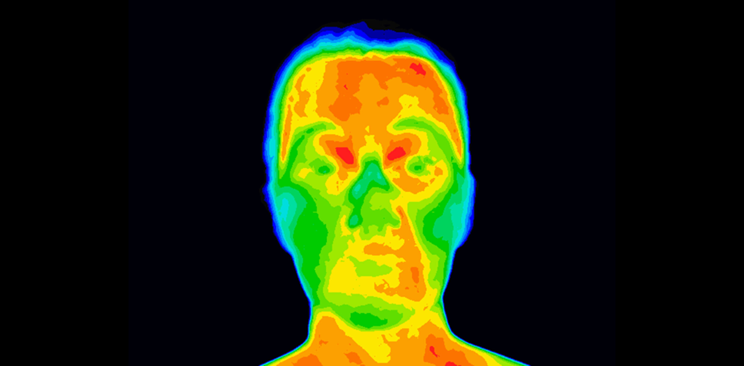 Thermal imaging